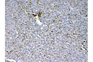 IHC analysis of HBD using anti-HBD antibody .
