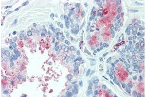 Anti-TSPAN13 antibody  ABIN960830 IHC staining of human prostate.