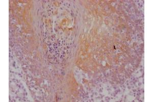 IHC image of ABIN7180967 diluted at 1:100 and staining in paraffin-embedded human tonsil tissue performed on a Leica BondTM system. (Cytokeratin 5 anticorps)