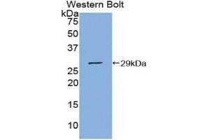Western Blotting (WB) image for anti-Protein Inhibitor of Activated STAT, 1 (PIAS1) (AA 409-645) antibody (ABIN3206150) (PIAS1 anticorps  (AA 409-645))