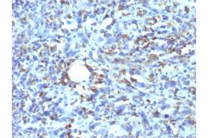Formalin-fixed, paraffin-embedded human Histiocytoma stained with CD68 Recombinant Mouse Monoclonal Antibody (rLAMP4/824). (Recombinant CD68 anticorps)