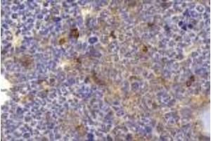 Immunohistochemistry analysis of paraffin-embedded mouse bone using BMP4 (ABIN7073215) at dilution of 1:2000. (BMP4 anticorps)