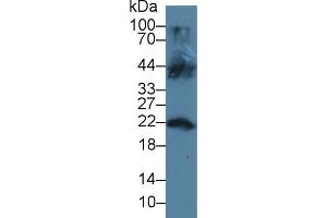 Western blot analysis of Mouse Testis lysate, using Human LCN12 Antibody (3 µg/ml) and HRP-conjugated Goat Anti-Rabbit antibody ( (LCN12 anticorps  (AA 61-184))