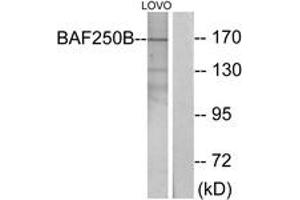 Western blot analysis of extracts from LOVO cells, using BAF250B Antibody. (ARID1B anticorps  (AA 1371-1420))
