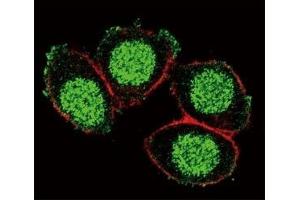 Confocal immunofluorescent analysis of PAX6 antibody with HeLa cells followed by Alexa Fluor 488-conjugated goat anti-rabbit lgG (green).