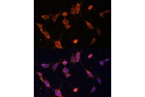anti-Ubiquitin-Fold Modifier Conjugating Enzyme 1 (UFC1) (AA 1-167) antibody