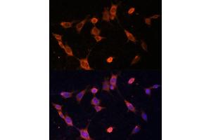 Immunofluorescence analysis of NIH-3T3 cells using UFC1 Polyclonal Antibody (ABIN6130770, ABIN6149886, ABIN6149887 and ABIN6217098) at dilution of 1:100 (40x lens). (UFC1 anticorps  (AA 1-167))