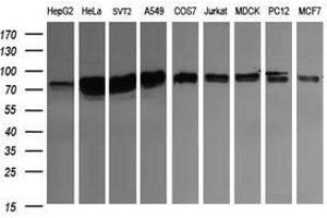 Image no. 3 for anti-CD22 Molecule (CD22) antibody (ABIN1497211) (CD22 anticorps)
