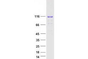 Validation with Western Blot