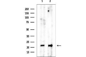 anti-NADH Dehydrogenase (Ubiquinone) 1 beta Subcomplex, 9, 22kDa (NDUFB9) (Internal Region) antibody