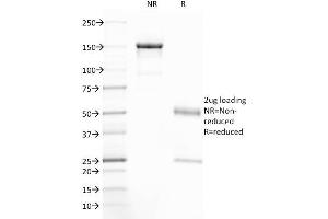 SDS-PAGE Analysis Purified CFTR Mouse Monoclonal Antibody (CFTR/1785). (CFTR anticorps  (AA 258-385))