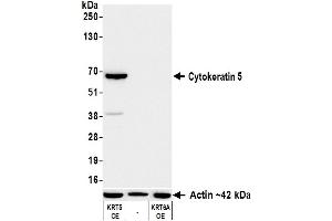 Western Blotting (WB) image for anti-Keratin 5 (KRT5) (C-Term) antibody (ABIN7795754)