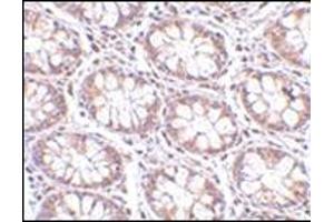 Immunohistochemistry of STEAP2 in human colon tissue with this product at 2.