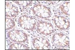 Immunohistochemistry of STEAP2 in human colon tissue with this product at 2. (STEAP2 anticorps  (C-Term))