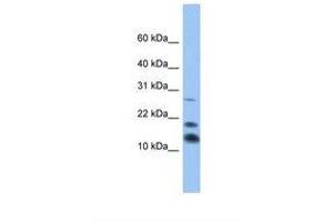Image no. 1 for anti-C1D Nuclear Receptor Corepressor (C1D) (AA 47-96) antibody (ABIN6738718)