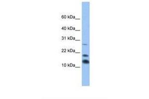 Image no. 1 for anti-C1D Nuclear Receptor Corepressor (C1D) (AA 47-96) antibody (ABIN6738718) (C1D anticorps  (AA 47-96))