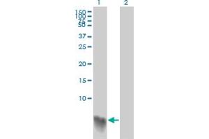 Western Blot analysis of S100A2 expression in transfected 293T cell line by S100A2 monoclonal antibody (M03A), clone 3H8. (S100A2 anticorps  (AA 1-97))
