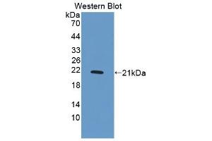 Detection of Recombinant PDGFBB, Human using Polyclonal Antibody to Platelet Derived Growth Factor BB (PDGF BB) (PDGF-BB Homodimer (AA 82-190) anticorps)