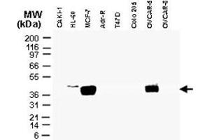 Western blot analysis of CARD8 in tumor cell lines. (CARD8 anticorps)