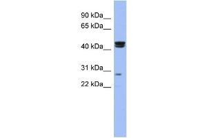 WB Suggested Anti-HSFY1 Antibody Titration:  0. (HSFY1 anticorps  (N-Term))