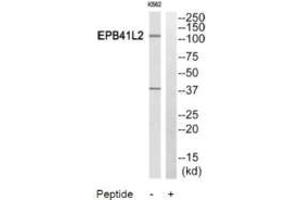 Western blot analysis of extracts from HuvEc cells and HeLa cells, using PPP2R5A antibody. (PPP2R5A anticorps)