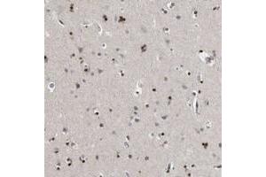 Immunohistochemical staining of human cerebral cortex with EVI5 polyclonal antibody  shows strong nuclear positivity in glial cells.
