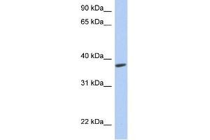 WB Suggested Anti-RTDR1 Antibody Titration: 0. (RTDR1 anticorps  (Middle Region))
