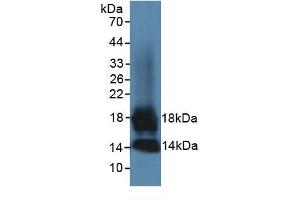 Rabbit Detection antibody from the kit in WB with Positive Control: Sample 293F transfected with MCP3 gene.