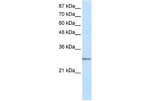 WB Suggested Anti-C20ORF20 Antibody Titration: 2. (MRGBP anticorps  (N-Term))