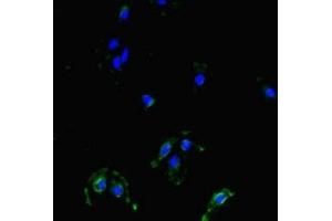 Immunofluorescent analysis of Hela cells using ABIN7159790 at dilution of 1:100 and Alexa Fluor 488-congugated AffiniPure Goat Anti-Rabbit IgG(H+L) (MAST1 anticorps  (AA 687-879))