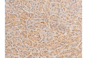 ABIN6267220 at 1/100 staining human pancreatic tissue sections by IHC-P.