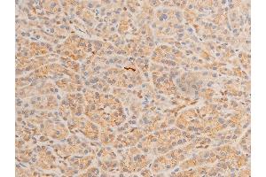 ABIN6267220 at 1/100 staining human pancreatic tissue sections by IHC-P.