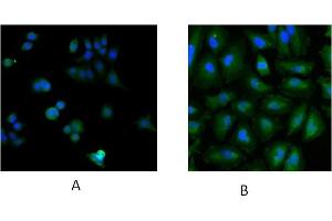 anti-Ubiquitin-Conjugating Enzyme E2L 3 (UBE2L3) (C-Term) antibody