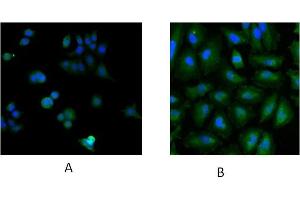Immunofluorescence staining of MCF7 (A) and HeLa (B) cells with 5ug/ml ABIN184900 antibody. (UBE2L3 anticorps  (C-Term))