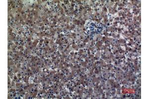 Immunohistochemistry (IHC) analysis of paraffin-embedded Human Liver, antibody was diluted at 1:100.