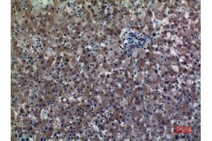 Immunohistochemistry (IHC) analysis of paraffin-embedded Human Liver, antibody was diluted at 1:100. (ALDH1A1 anticorps  (N-Term))