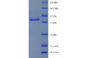 SDS-PAGE (SDS) image for MAP3K7 C-Terminal Like (MAP3K7CL) (AA 1-142), (full length) protein (His-SUMO Tag) (ABIN5710960)