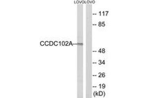 Western blot analysis of extracts from LOVO cells, using CCDC102A Antibody. (CCDC102A anticorps  (AA 341-390))