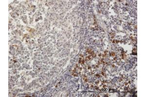 Immunoperoxidase of purified MaxPab antibody to TXNDC5 on formalin-fixed paraffin-embedded human lymph node.