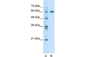 WB Suggested Anti-PDLIM5 Antibody Titration:  2. (PDLIM5 anticorps  (C-Term))