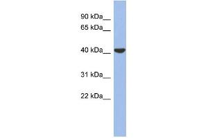 WB Suggested Anti-GJD4 Antibody Titration:  0. (GJD4 anticorps  (Middle Region))