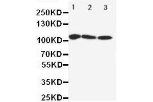 Anti-SERCA1 ATPase antibody, Western blotting Lane 1: Rat Skeletal Muscle Tissue Lysate Lane 2: PANC Cell Lysate Lane 3: U87 Cell Lysate
