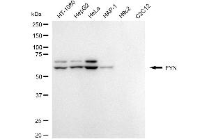 Western blotting analysis using FYN antibody (ABIN7798670).