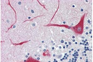 Human Brain, Cerebellum: Formalin-Fixed, Paraffin-Embedded (FFPE)