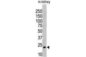 The ISG15 polyclonal antibody  is used in Western blot to detect ISG15 in mouse kidney tissue lysate. (ISG15 anticorps  (N-Term))