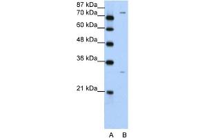 WB Suggested Anti-PTGS1 Antibody Titration:  5. (PTGS1 anticorps  (N-Term))