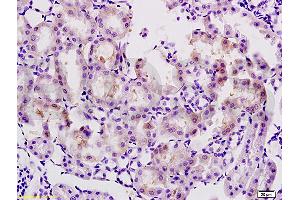 Formalin-fixed and paraffin embedded rat kidney tissue labeled with Anti-AGEs Polyclonal Antibody, Unconjugated (ABIN738516) at 1:200 followed by conjugation to the secondary antibody and DAB staining