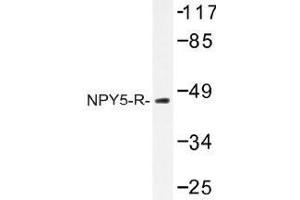 Image no. 1 for anti-Neuropeptide Y Receptor Y5 (NPY5R) antibody (ABIN317759)