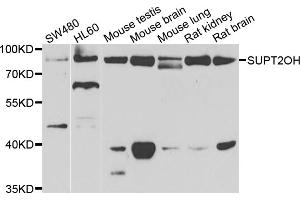 Western blot analysis of extracts of various cell lines, using SUPT20H antibody (ABIN5975125) at 1/1000 dilution. (FAM48A/P38IP anticorps)