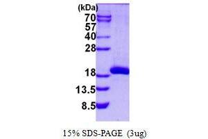 Image no. 1 for Spermidine/Spermine N1-Acetyltransferase 2 (SAT2) protein (His tag) (ABIN1098224) (SAT2 Protein (His tag))